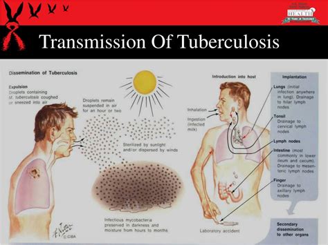 How is Tuberculosis Transmitted?