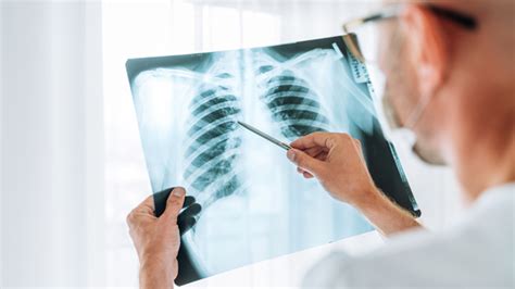 15 Incredible Vintage Photos of People Getting XRays Over the Decades Vintage Everyday