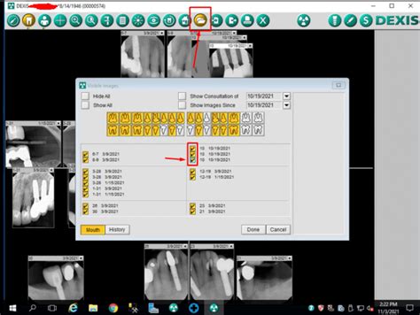 DEXIS Digital XRay Tomy Online