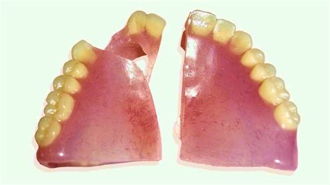 SUPERFIX Now you can fix your broken denture at home YouTube
