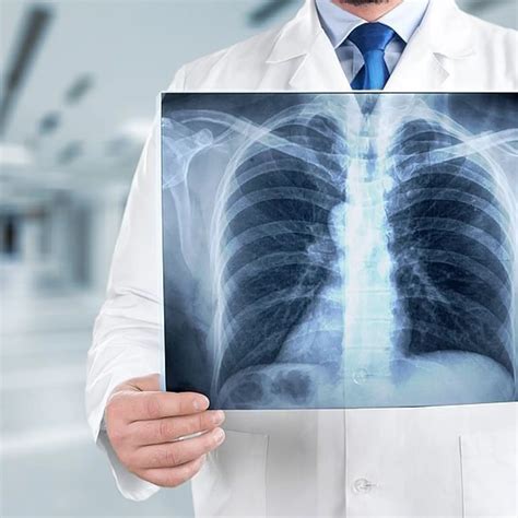 How Often Should You Get XRays at the Dentist?