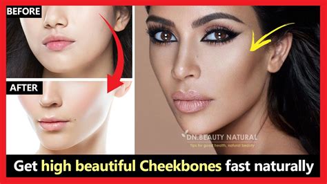 How To Get Defined/High Cheekbones With Cheek Filler in San Francisco Mabrie Facial Institute
