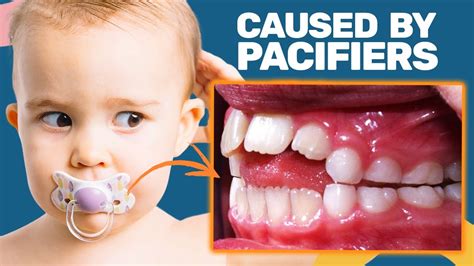 How to Deal With Teeth Grinding and Jaw Clenching That Might Be More Serious Than Usual Allure