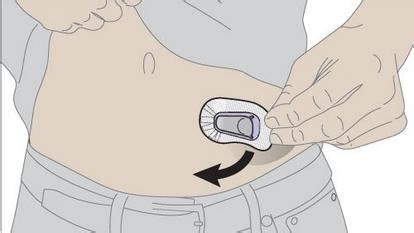 How to Remove a G4 or G5 Transmitter from a Sensor YouTube