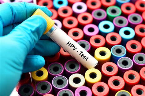 hpv blood test