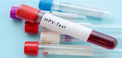 hpv dna blood test