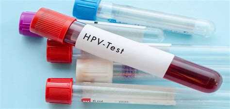 hpv dna test negative