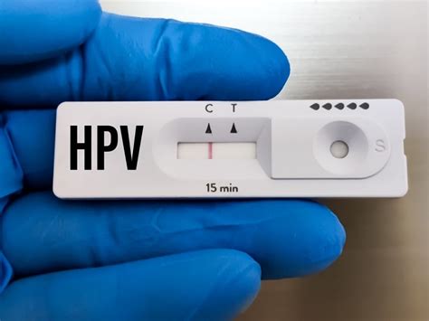 HPV How to Test: A Simple Guide to Screening Options