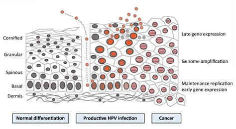hpv virus and squamous cell carcinoma