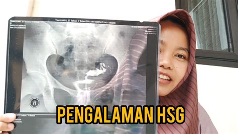 hsg itu apa