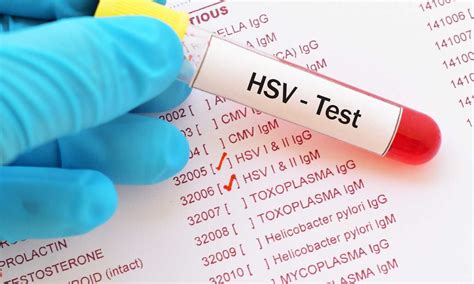 hsv 1 and 2 blood test