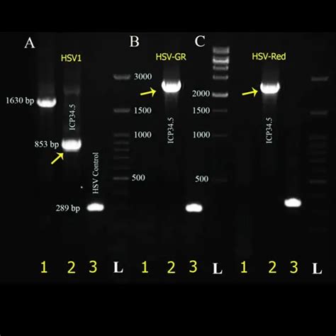 hsv 1 and 2 dna