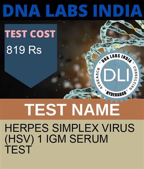 hsv labcorp serum