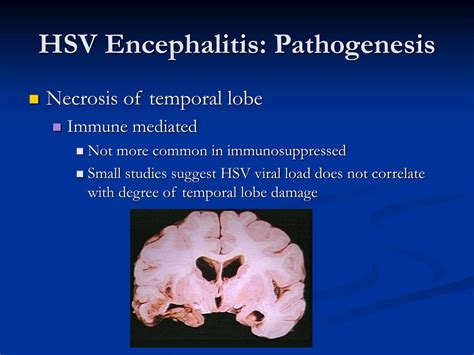 hsv type 2 encephalitis