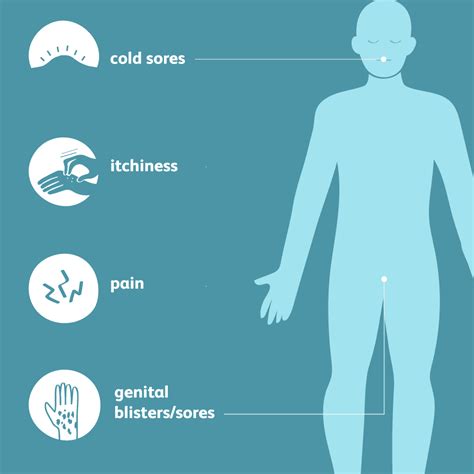 hsv-2 symptoms in males