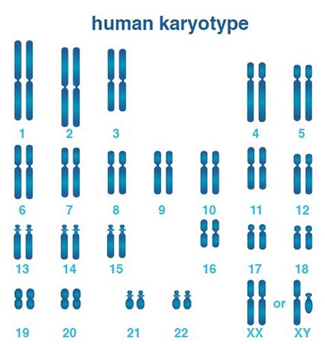 Kelainan kromosom