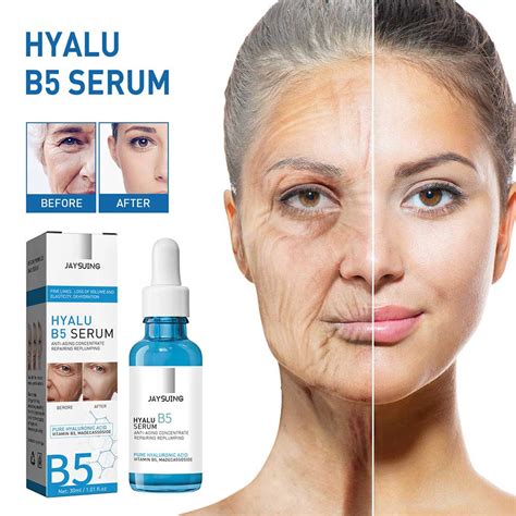 hyalu b5 serum jaysuing review