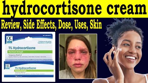 Hydrocortisone Cream Side Effects: What You Need to Know