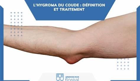 hygroma du coude L'institut de chirurgie de la main de l