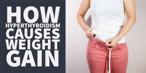 Hyperthyroidism Methimazole Weight Gain