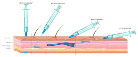 Hypodermic Injection Example