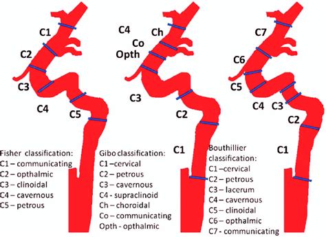 ica segments