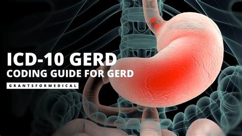 icd 10 code for gerd with esophagitis