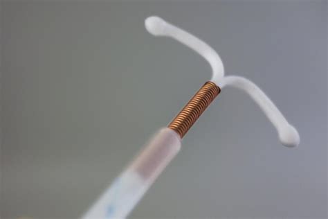 icd 10 code for iud removal and replacement