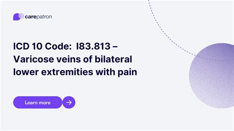 icd 10 for varicose veins bilateral