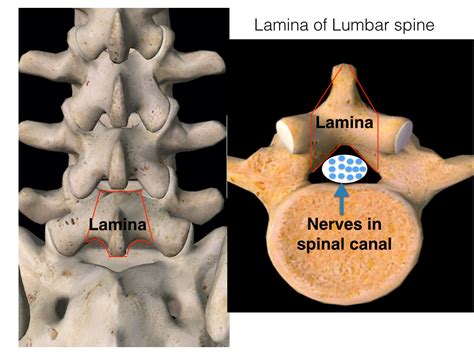 icd 10 laminectomy lumbar spine