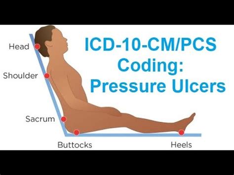 icd10 buttock pain