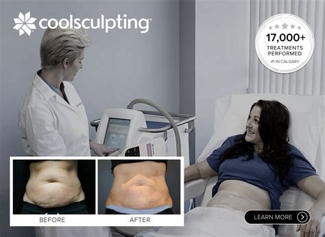 ideal image prices for coolsculpting