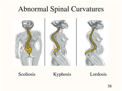 identifying abnormal spine curvature