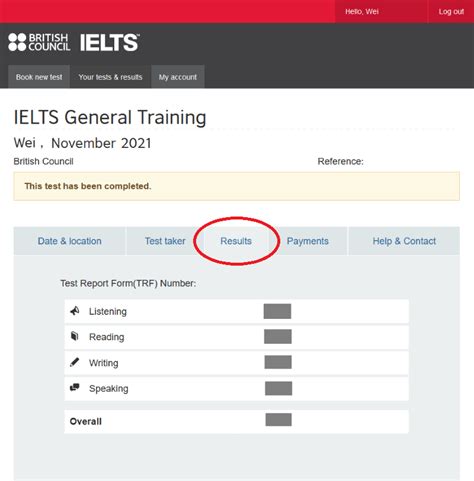 IELTS Exam Result 2020 Check your Score here Embibe Exams