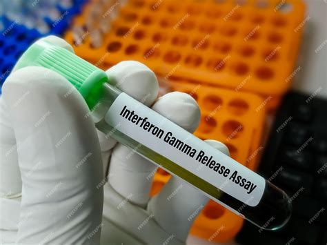 ifn gamma tuberculosis