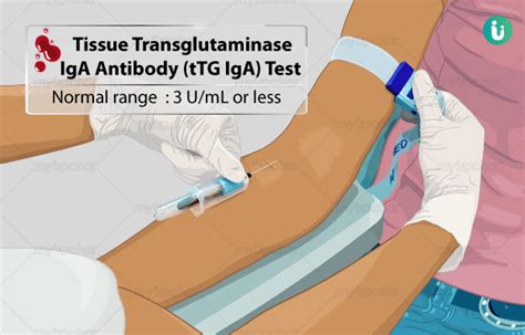 iga transglutaminase antibody test