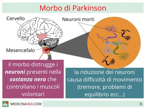 il morbo di parkinson che cos'e