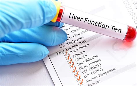 Liver Function Tests (LFTs)
