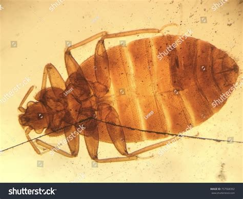 Image Of Bed Bug Under Microscope