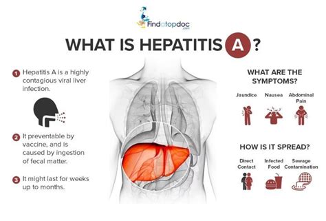 image of hepatitis a
