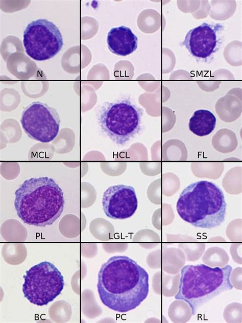 Image Processing And Machine Learning In The Morphological Analysis Of Blood Cells