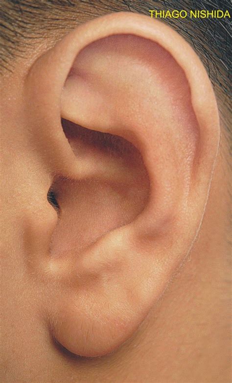imagem de uma orelha
