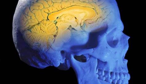 Human Skull Cross-section With Brain Photograph by Leonello Calvetti