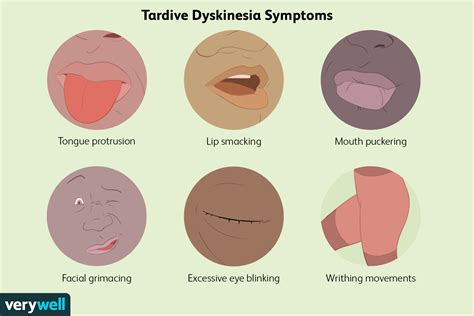 images of tardive dyskinesia