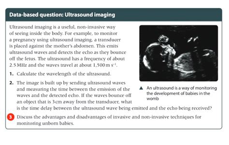 imaging question meaning