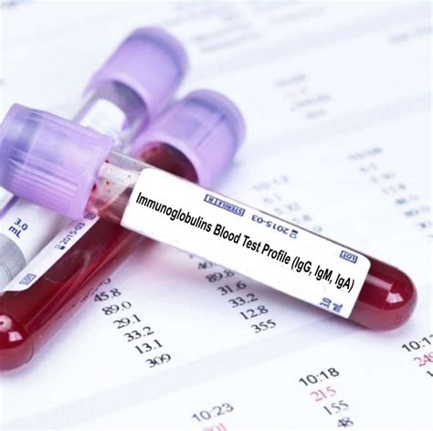 immunoglobulins igg iga igm blood test