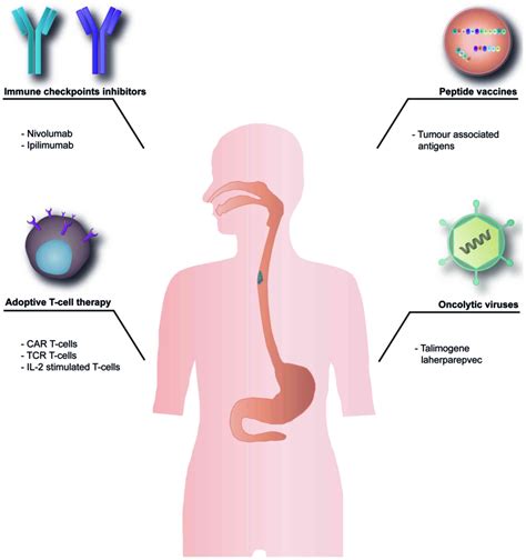 immunotherapy for esophageal cancer