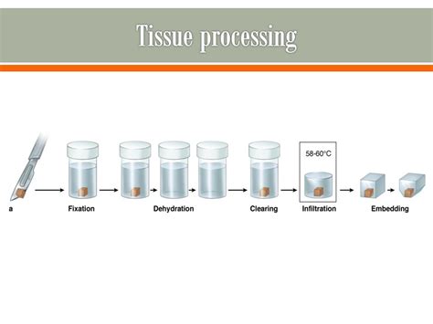 Importance Of Fixation In Tissue Processing