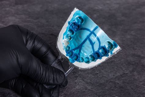 Impression Materials Examples