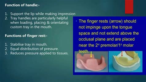 Impression Tray Function